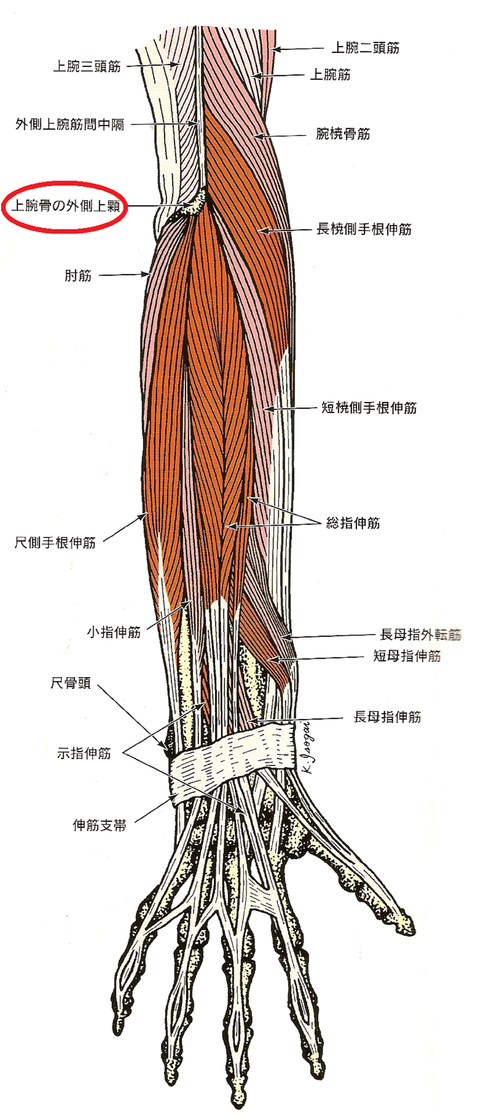 上 腕骨 外側 上 顆 炎